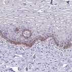 Immunohistochemical staining of human cervix, uterine shows moderate to strong cytoplasmic positivity in glandular cells.