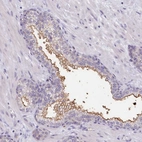 Immunohistochemical staining of human prostate shows moderate to strong positivity in plasma membrane in glandular cells.