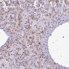 Immunohistochemical staining of human liver shows moderate to strong positivity in canaliculi in hepatocytes.