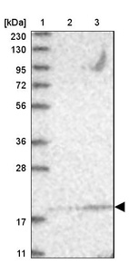 Lane 1: Marker [kDa] 230, 130, 95, 72, 56, 36, 28, 17, 11_br/_Lane 2: Human cell line RT-4_br/_Lane 3: Human cell line U-251MG sp