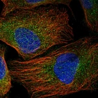 Immunofluorescent staining of human cell line U-2 OS shows positivity in cytoplasm.