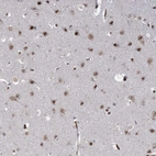 Immunohistochemical staining of human cerebral cortex shows moderate to strong nuclear positivity in neurons.