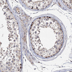Immunohistochemical staining of human testis shows strong nuclear positivity in cells in seminiferous ducts.