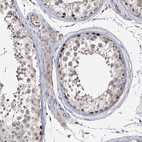 Anti-NSMCE4A Antibody