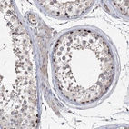 Immunohistochemical staining of human testis shows strong nuclear positivity in cells in seminiferous ducts.