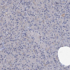 Immunohistochemical staining of human pancreas shows no positivity in exocrine glandular cells as expected.