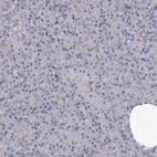 Immunohistochemical staining of human pancreas shows no positivity in exocrine glandular cells as expected.