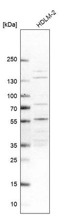 Western blot analysis in human cell line HDLM-2.
