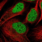 Immunofluorescent staining of human cell line U-2 OS shows localization to nucleoplasm.