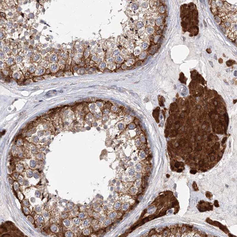 Anti-PCYOX1L Antibody