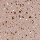 Immunohistochemical staining of human cerebral cortex shows strong cytoplasmic positivity in neuronal cells.