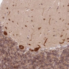 Immunohistochemical staining of human cerebellum shows strong cytoplasmic positivity in Purkinje cells and cells in molecular layers.