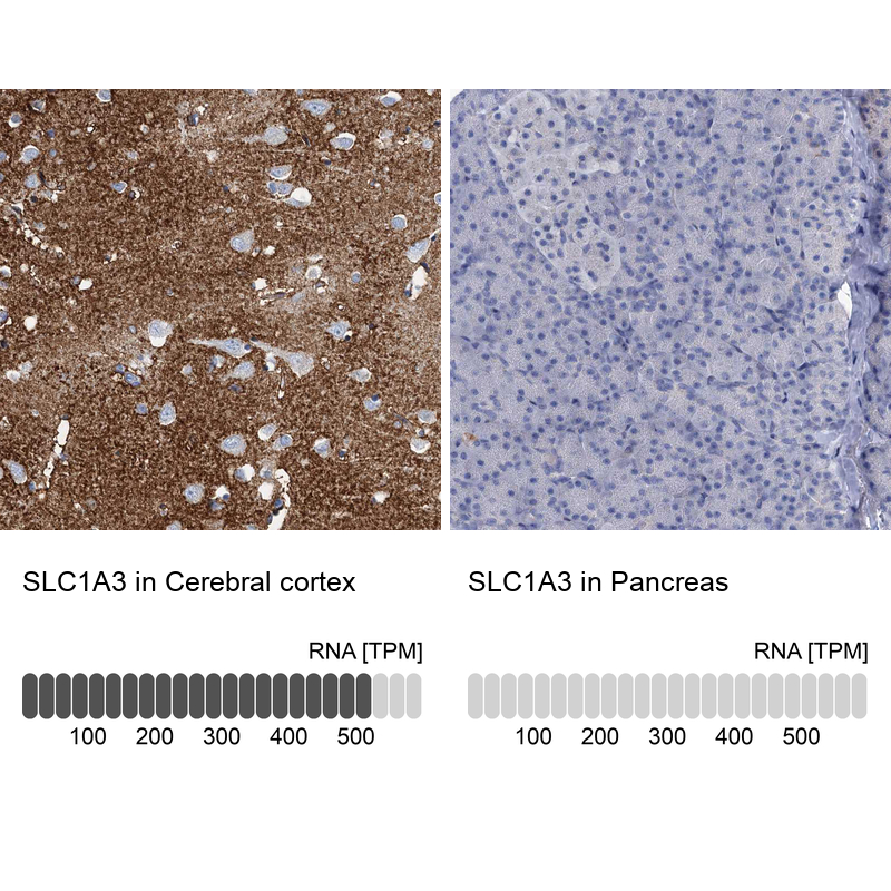 Anti-SLC1A3 Antibody