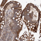 Immunohistochemical staining of human small intestine shows strong cytoplasmic positivity in glandular cells.