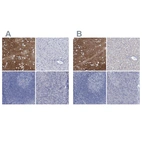 Immunohistochemical staining of human cerebral cortex, liver, lymph node and pancreas using Anti-SLC1A3 antibody HPA037467 (A) shows similar protein distribution across tissues to independent antibody HPA037468 (B).