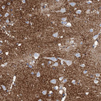 Anti-SLC1A3 Antibody