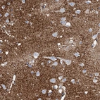 Immunohistochemical staining of human cerebral cortex shows strong cytoplasmic positivity in neuropil.