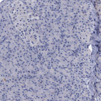 Immunohistochemical staining of human pancreas shows no positivity in exocrine glandular cells as expected.