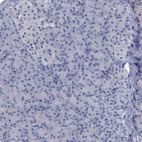 Anti-SLC1A3 Antibody