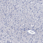 Anti-SLC1A3 Antibody