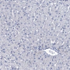 Immunohistochemical staining of human liver shows no positivity in hepatocytes.