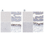 Immunohistochemical staining of human cerebral cortex, fallopian tube, liver and nasopharynx using Anti-DNAH5 antibody HPA037470 (A) shows similar protein distribution across tissues to independent antibody HPA037469 (B).