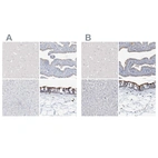 Immunohistochemical staining of human cerebral cortex, fallopian tube, liver and nasopharynx using Anti-DNAH5 antibody HPA037470 (A) shows similar protein distribution across tissues to independent antibody HPA037469 (B).