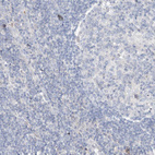 Immunohistochemical staining of human lymph node shows no positivity as expected.
