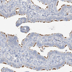 Immunohistochemical staining of human Fallopian tube shows strong positivity in cilia in glandular cells.