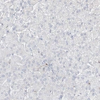 Immunohistochemical staining of human liver shows no positivity in hepatocytes as expected.