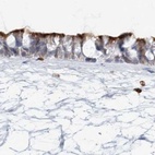 Immunohistochemical staining of human nasopharynx using Anti-DNAH5 antibody HPA037470.