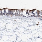 Anti-DNAH5 Antibody