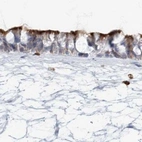Immunohistochemical staining of human nasopharynx using Anti-DNAH5 antibody HPA037470.