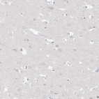 Immunohistochemical staining of human cerebral cortex shows no positivity in neurons as expected.