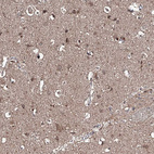 Anti-RANBP3L Antibody