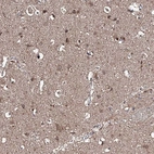 Anti-RANBP3L Antibody