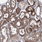 Immunohistochemical staining of human kidney shows strong cytoplasmic positivity in cells in tubules.