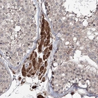 Immunohistochemical staining of human testis shows strong cytoplasmic positivity in Leydig cells.