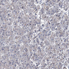 Immunohistochemical staining of human pancreas shows no positivity in exocrine glandular cells as expected.