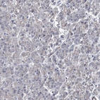 Immunohistochemical staining of human pancreas shows no positivity in exocrine glandular cells as expected.