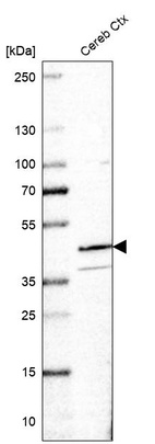 Western blot analysis in human cerebral cortex tissue.