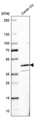 Anti-RANBP3L Antibody