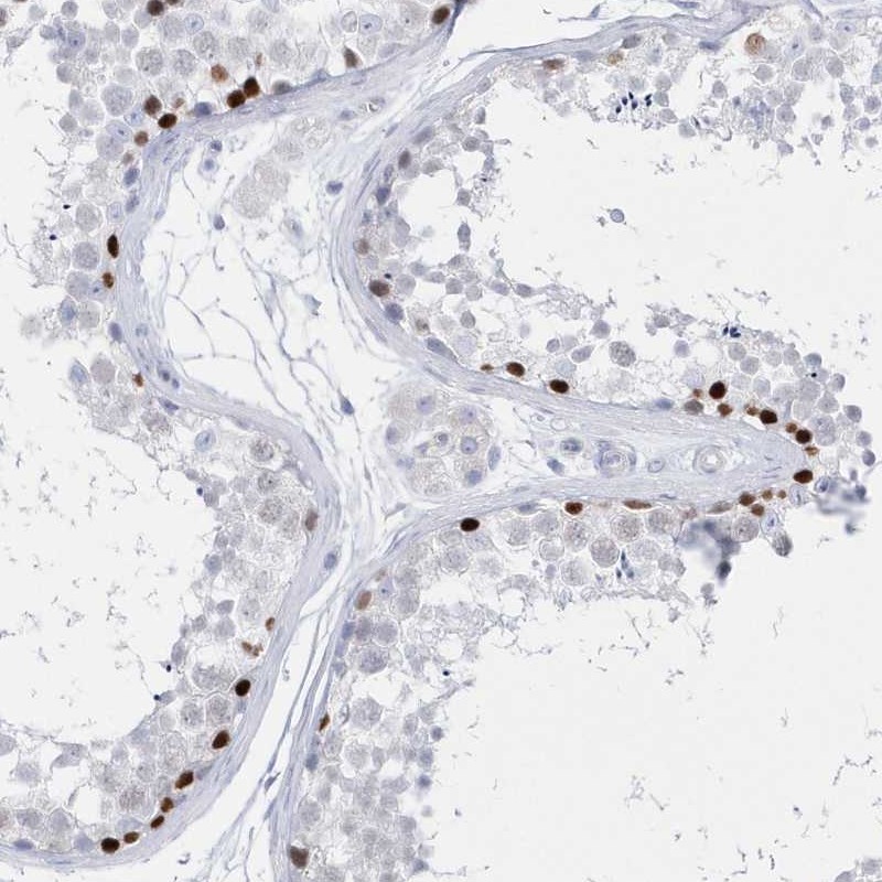 Anti-TMCO6 Antibody
