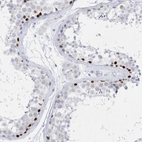 Anti-TMCO6 Antibody