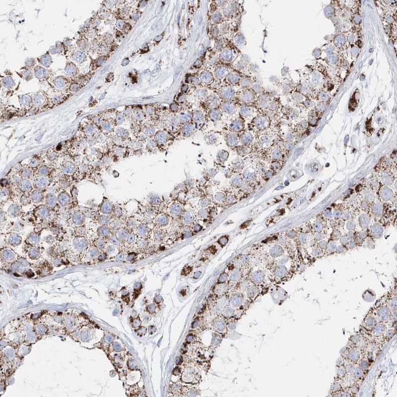 Anti-TMCO6 Antibody