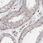 Anti-TMCO6 Antibody