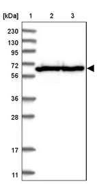 Lane 1: Marker [kDa] 230, 130, 95, 72, 56, 36, 28, 17, 11_br/_Lane 2: Human cell line RT-4_br/_Lane 3: Human cell line U-251MG sp