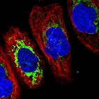 Immunofluorescent staining of human cell line A-431 shows localization to mitochondria.
