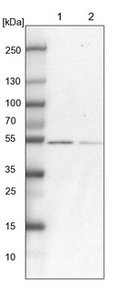 Anti-RBM17 Antibody