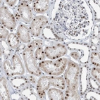 Immunohistochemical staining of human kidney shows strong nuclear positivity in cells in tubules.